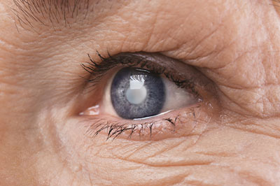 Vision World of Copiague | Contact Lens Exams, Comprehensive Eye Exams and Diabetic Eye Exams